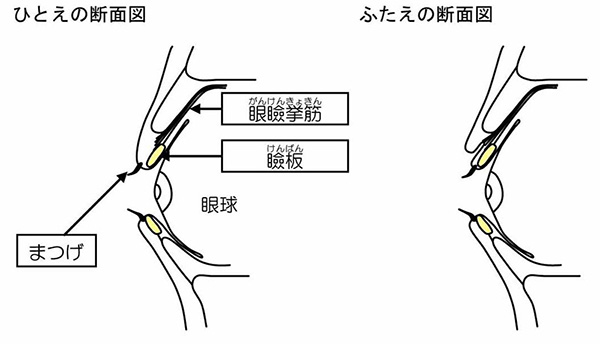 ひとえの断面図・ふたえの断面図